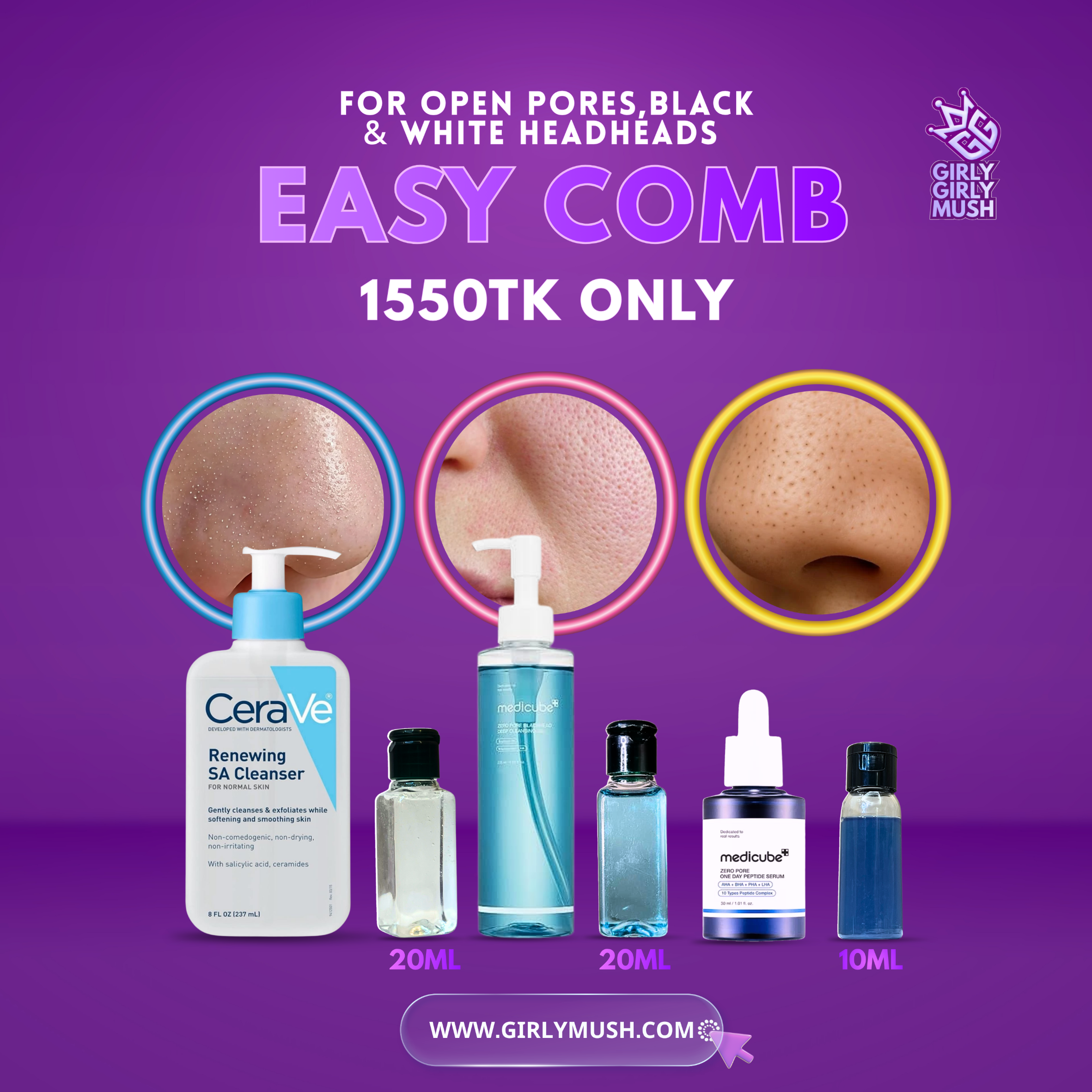Blackheads & Whiteheads