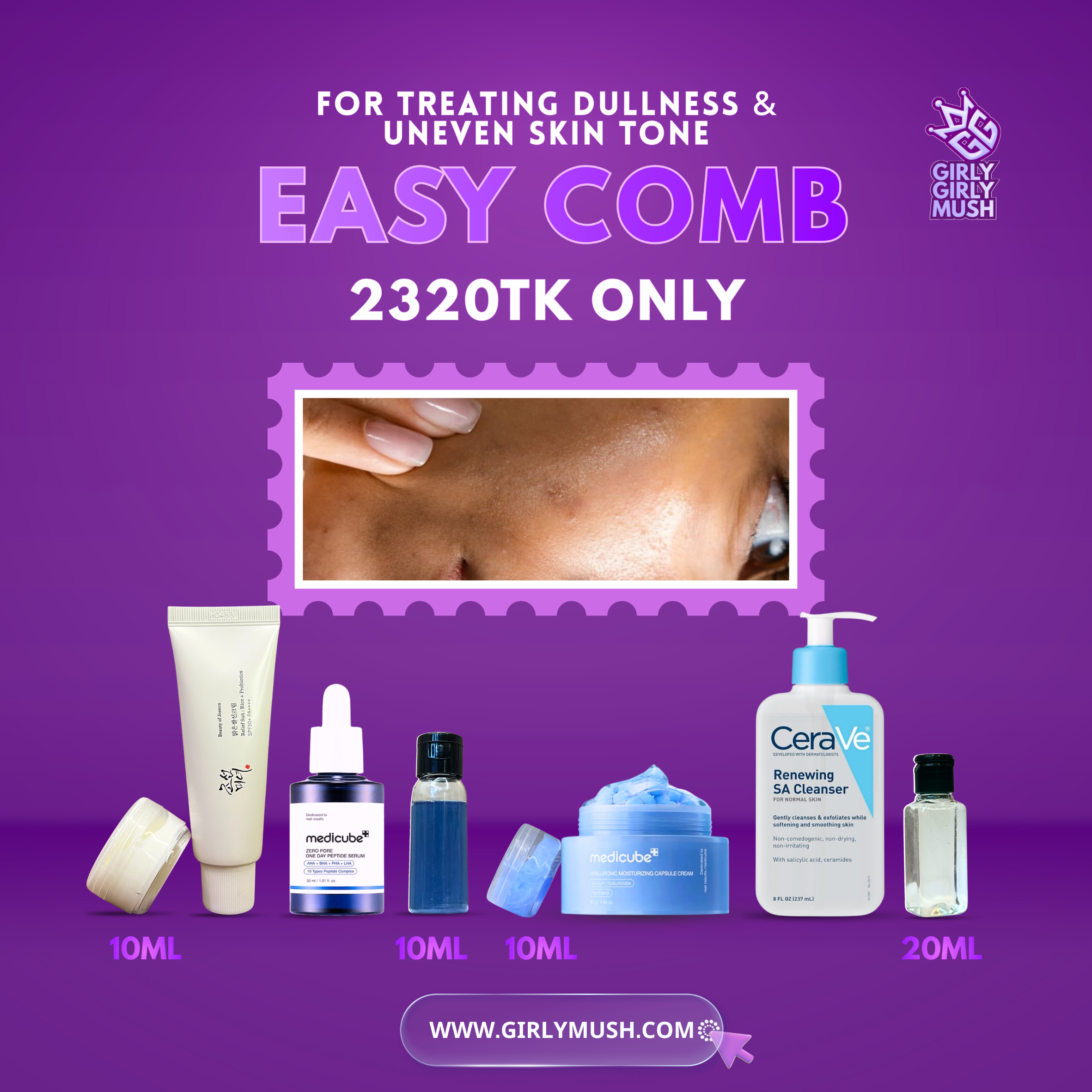Dullness & Uneven Skin Tone